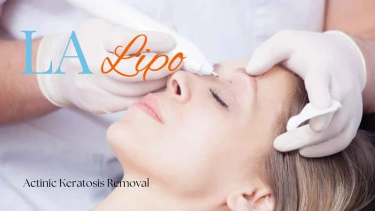Woman receiving Actinic Keratosis Removal Treatment Houghton Regis