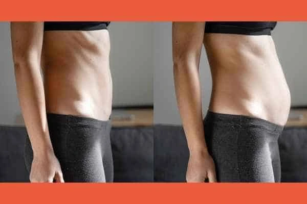 LA-EMS Body Sculpting results Houghton Regis