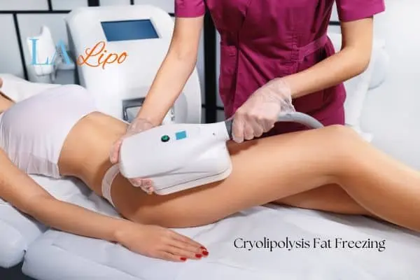 Woman receiving coolsculpting Houghton Regis treatment on her thighs