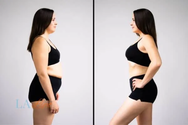 link between body image and mental health Houghton Regis