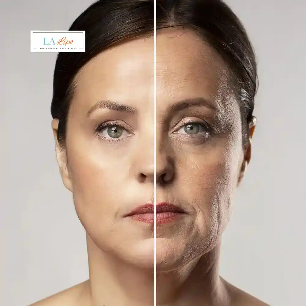 How Can You Tell If Non-Surgical Skin Tightening Is Right for You Houghton Regis?