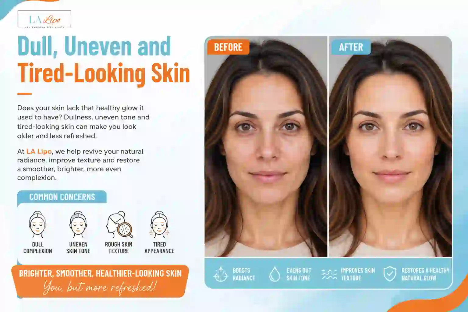Sign #5: Dull, Uneven and Tired-Looking Skin Houghton Regis