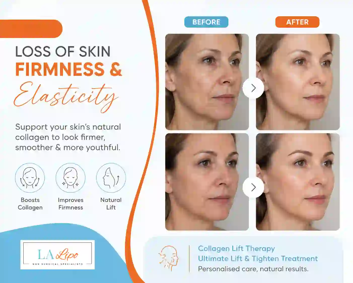 Sign #7: Loss of Skin Firmness and Elasticity Houghton Regis
