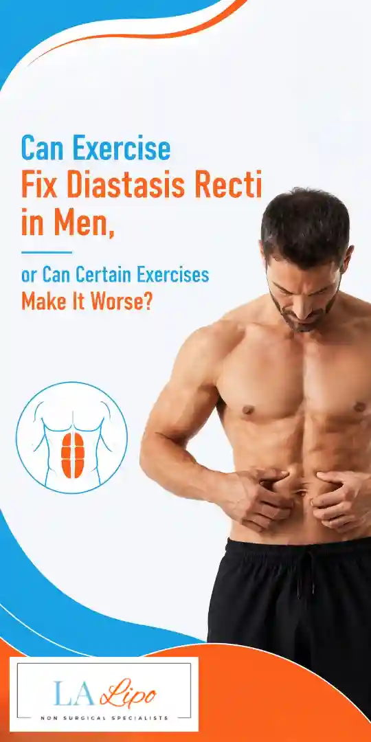 Can Exercise Fix Diastasis Recti in Men, or Can Certain Exercises Make It Worse Houghton Regis?